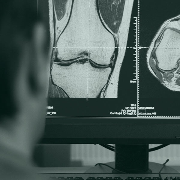 Settimana di prevenzione dell'osteporosi 24-29 novembre