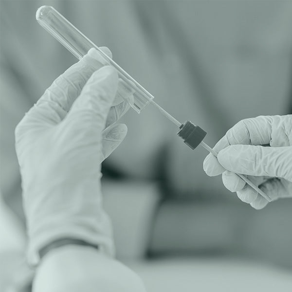 Tampone Mononucleosi